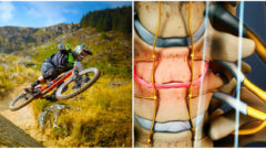 Lekári vyvinuli prístroj