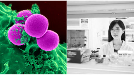 Študentka našla spôsob,