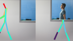 Zabudni na röntgen.