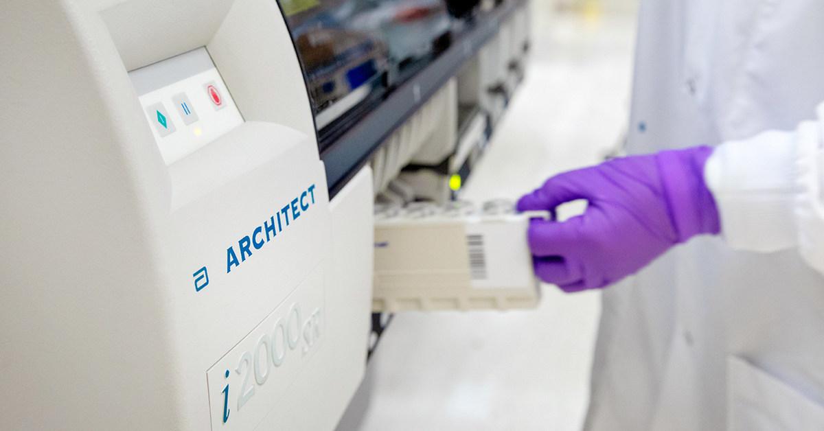 Americká firma vyvíja nový rýchlo test na COVID - 19