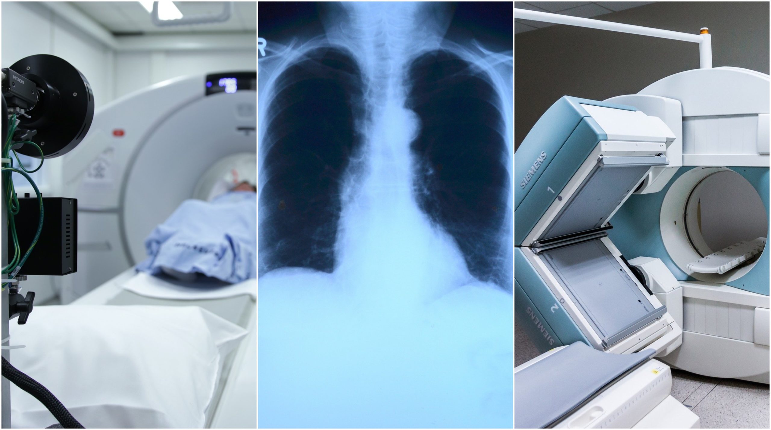 CT, rontgen, magnetická rezonancia