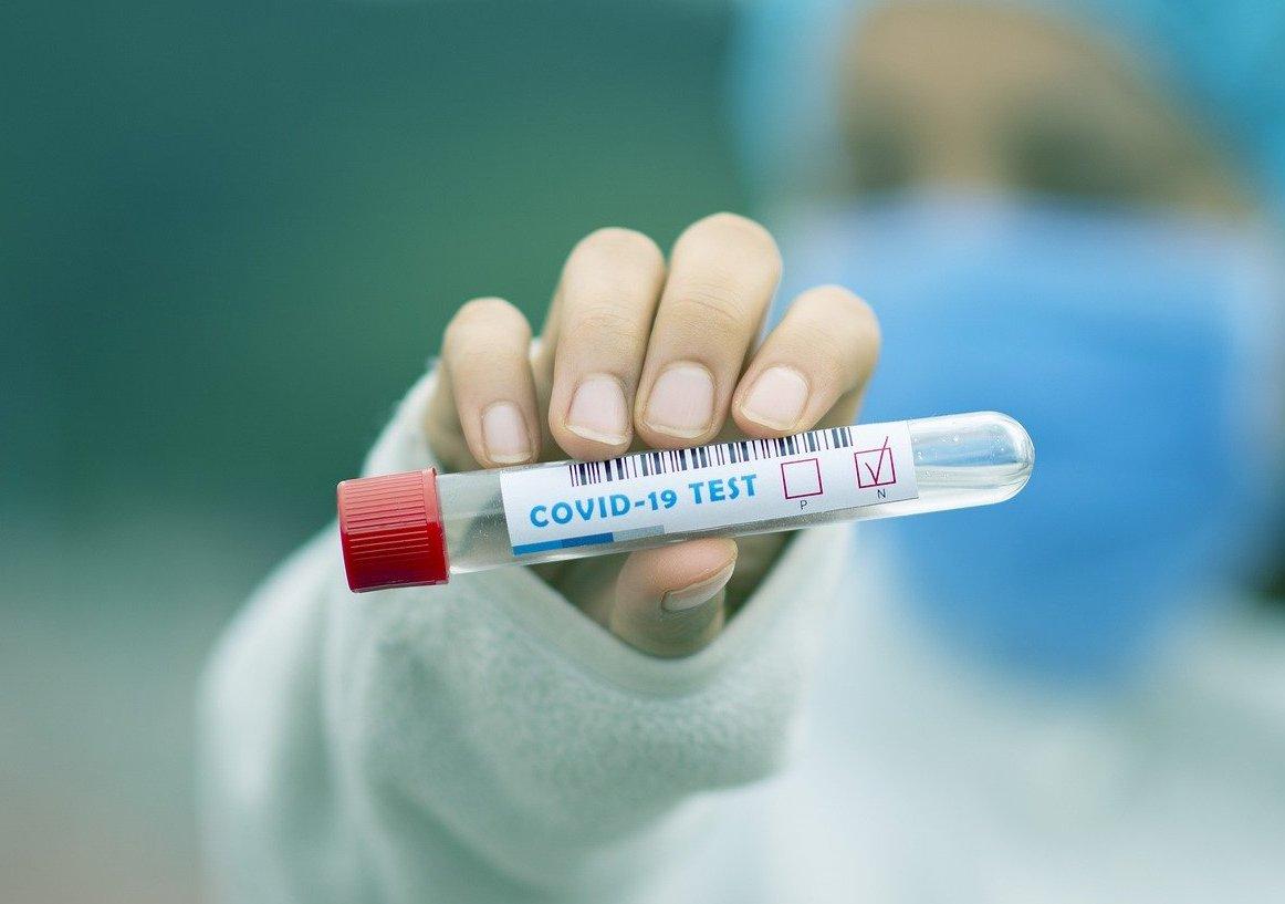 koronavírus, test, testovanie