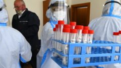 testovanie na koronavírus