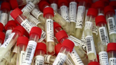 testy na koronavírus