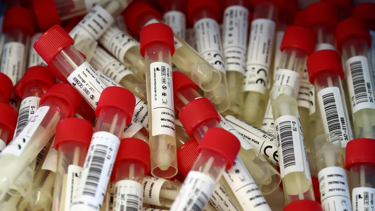 testy na koronavírus