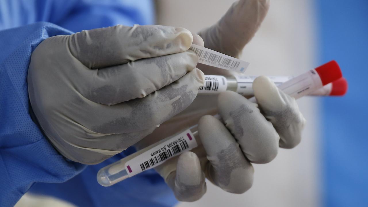 testovanie na koronavírus