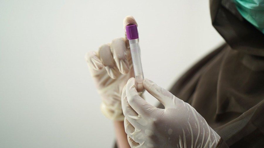 krvný test, laboratórium