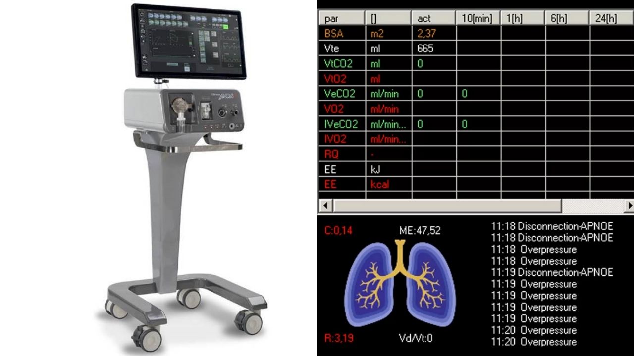 Aura-V pľúcny ventilátor
