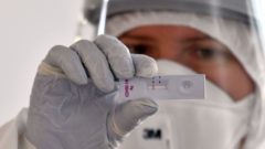 antigénový test plošné testovanie