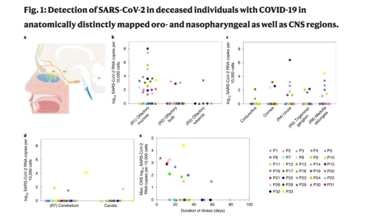 covid prechod nosohltan
