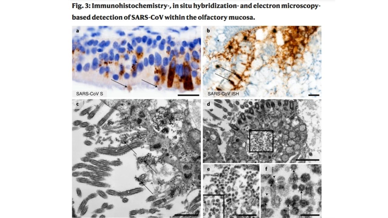 covid prechod nosohltan