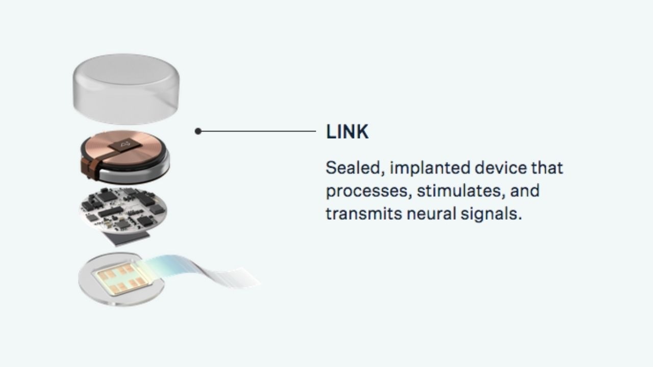 Neuralink implantát