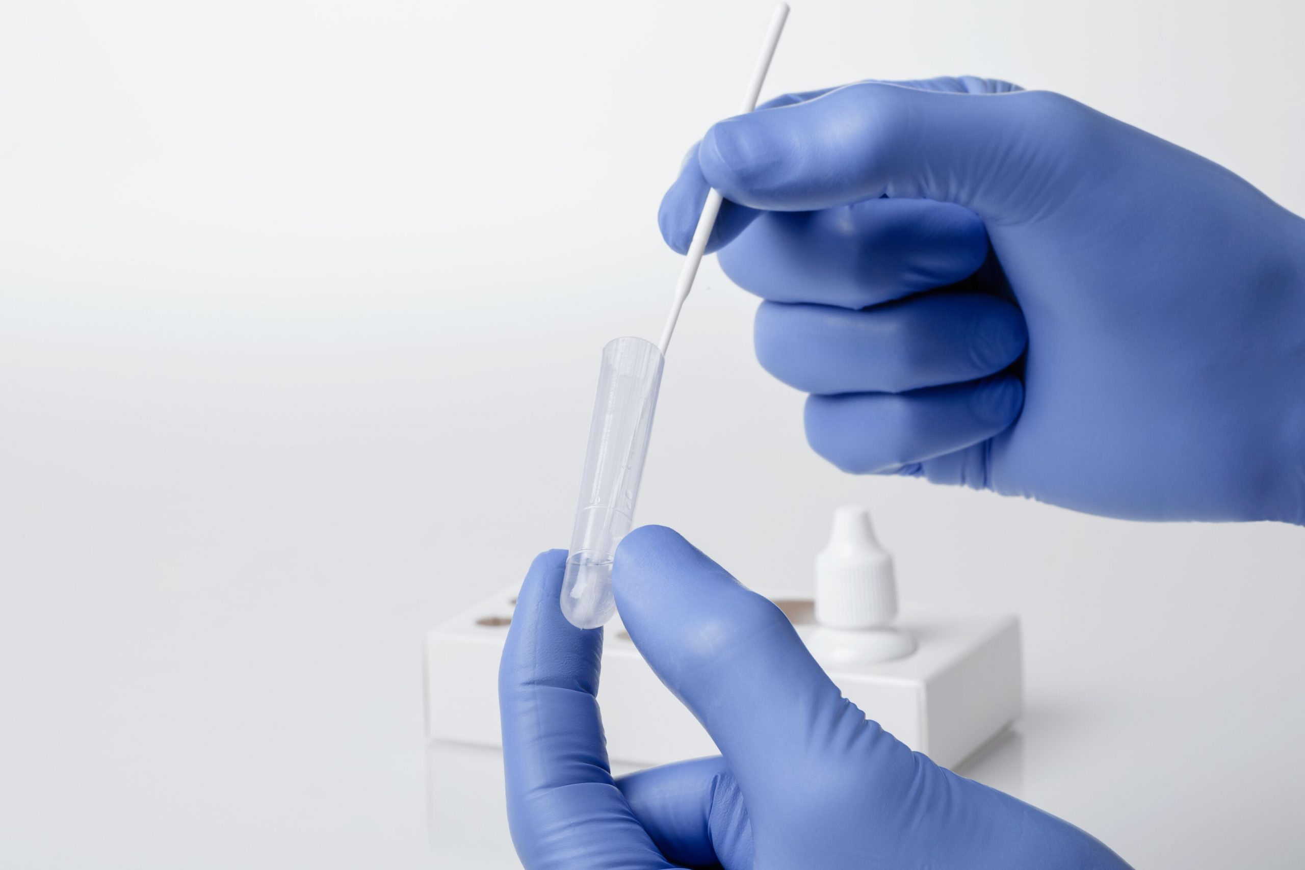 Ilustračné foto_Ag test_Zdroj_Siemens Healthineers