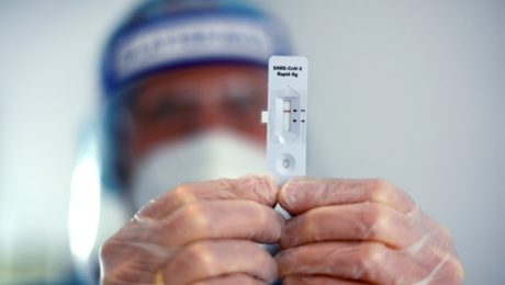 Na snímke muž, ktorý v rukách drží PCR test.