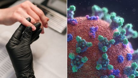 Po prekonaní COVID-19