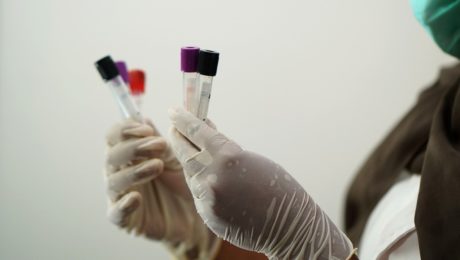 laboratorium, vzorky