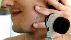 melanóm rakovina kože