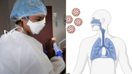 Covid-19, prirodzená imunita