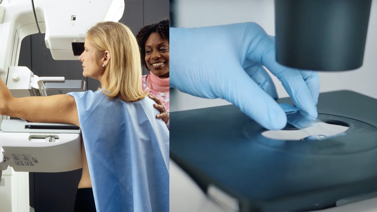 rakovina prsníka, žena na vyšetrení