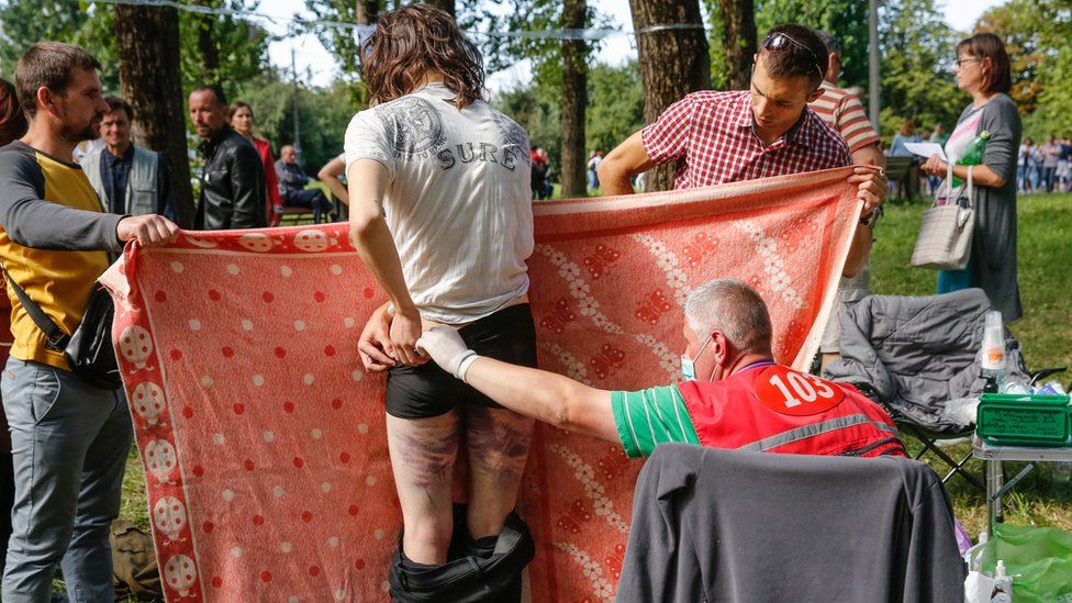 Prepustenému demonštrantovi ošetrujú rany rovno pred Okrestinou