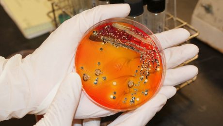 petriho miska baktérie salmonela