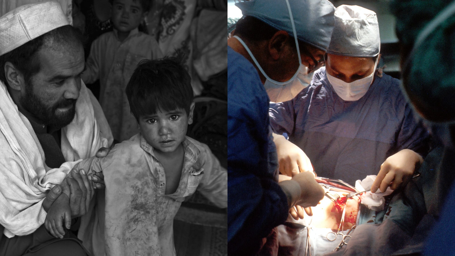 dieta afganistan operacia