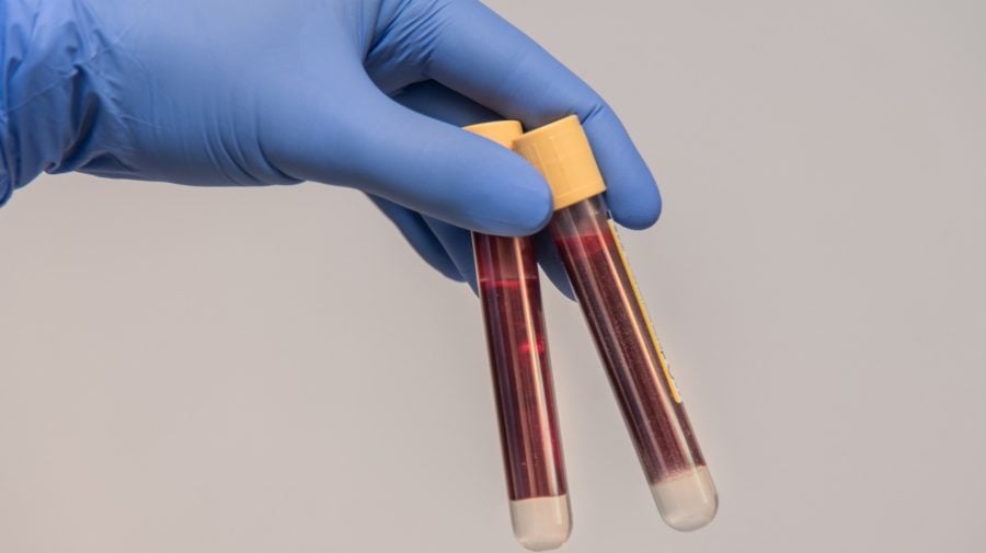 krv odber vzorka test