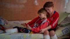 Zranenie spôsobené útokmi na Ukrajinu.