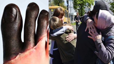 Laboratórny asistent prehovoril