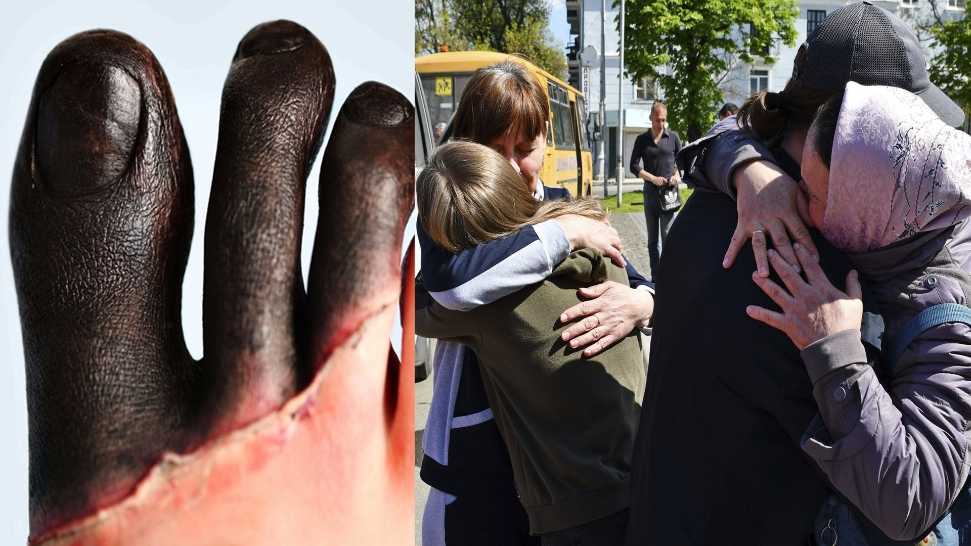 omrzliny ruský zajatec