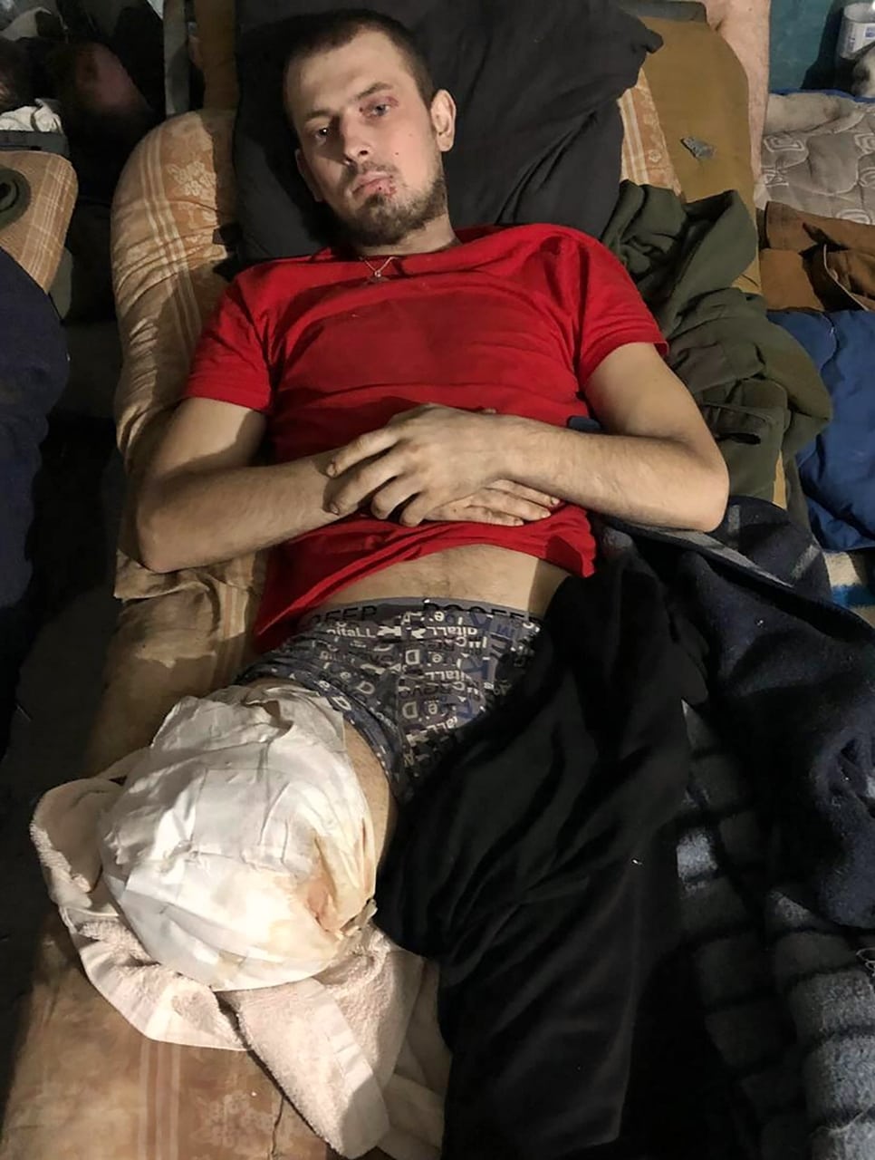 Ukrajina amputované nohy