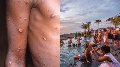 WHO pomenovalo živnú