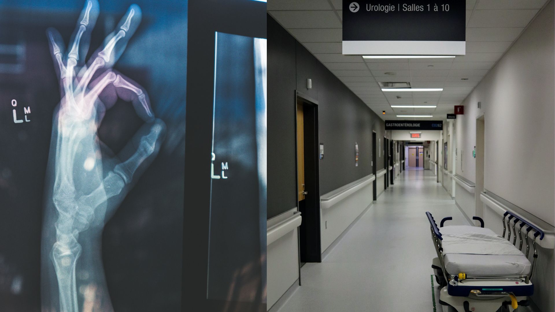 nemocničná chodba a ruka ukazujúca OK
