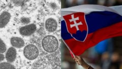 vírus opičích kiahní a slovenská vlajka