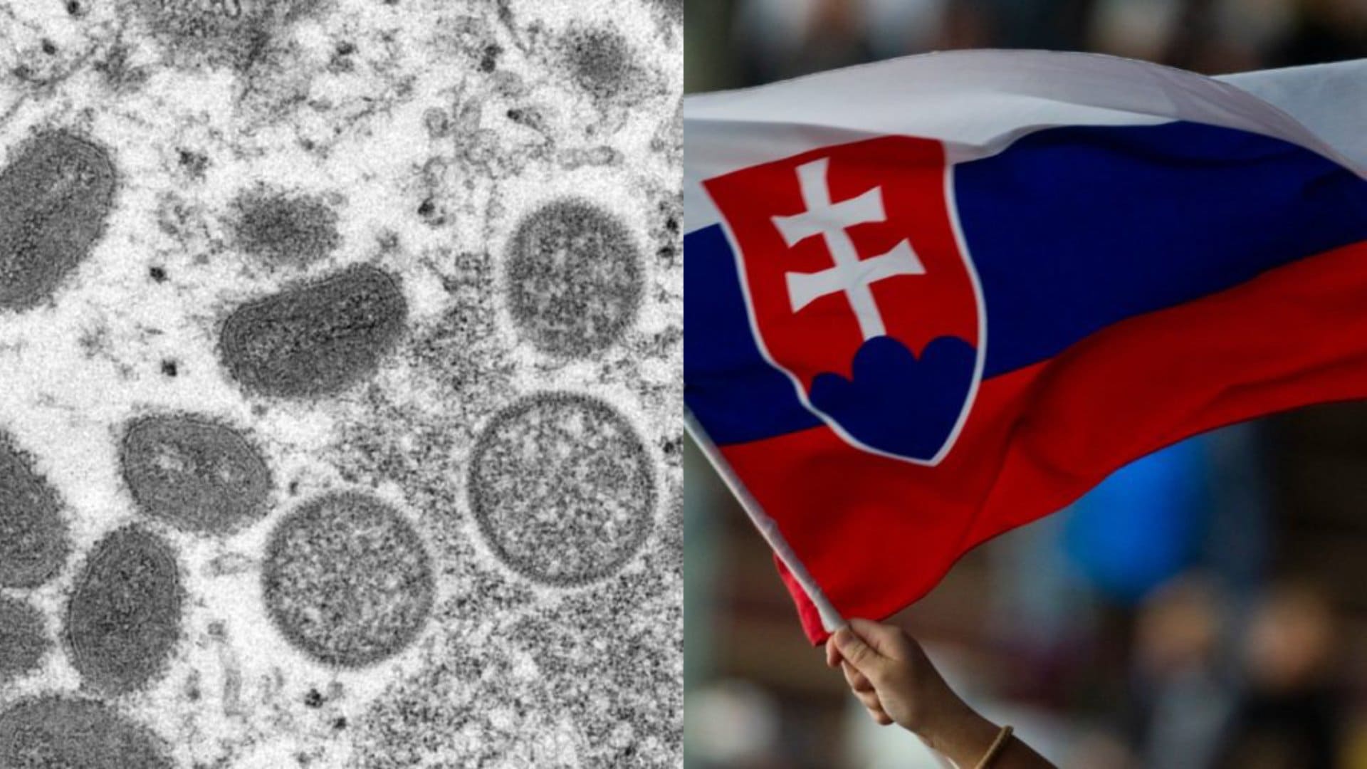 vírus opičích kiahní a slovenská vlajka