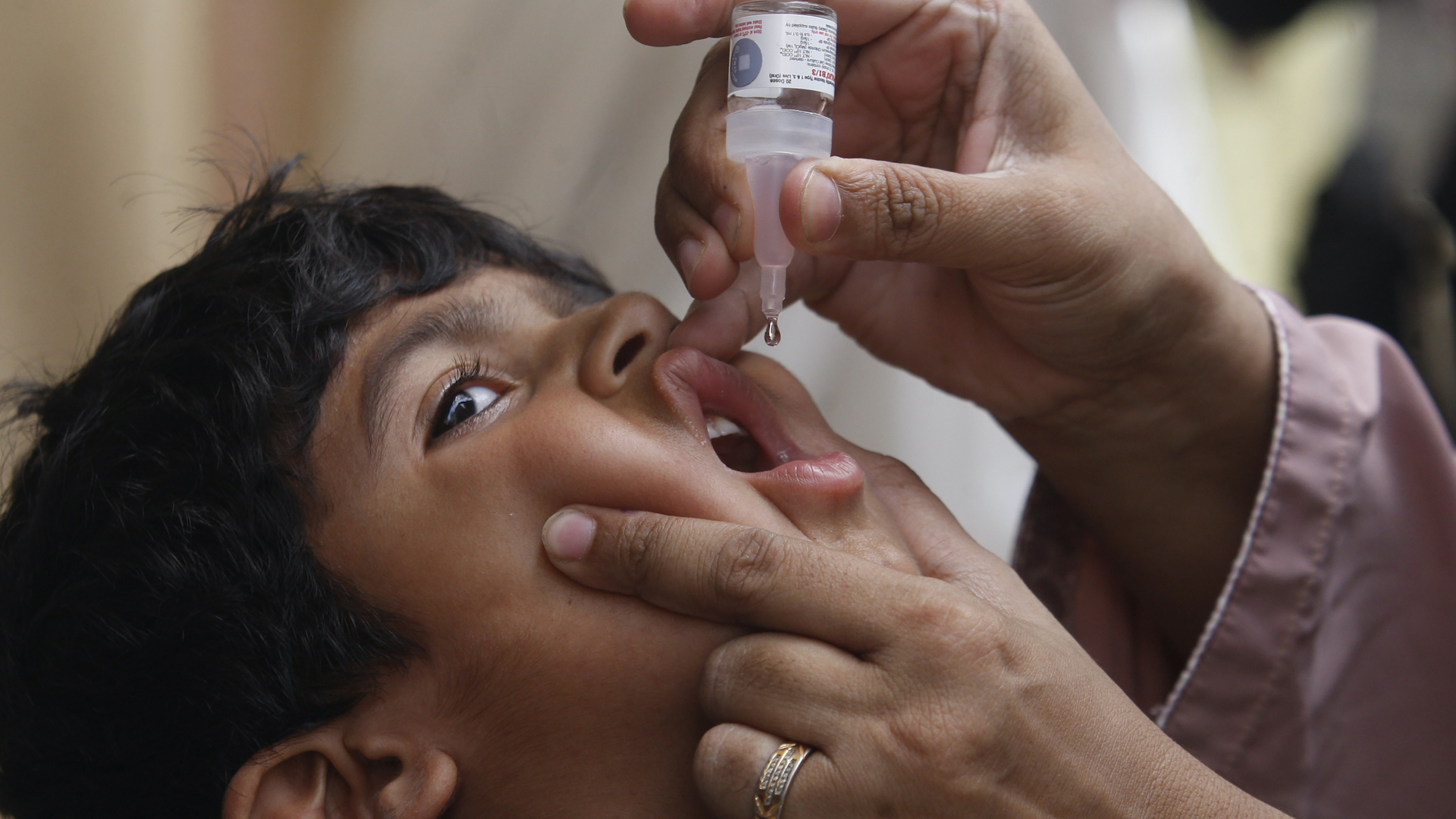 dieťa očkovanie proti poliovírusu obrna