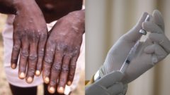 EMA rieši očkovanie