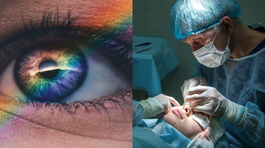 iclinic, operácia očí