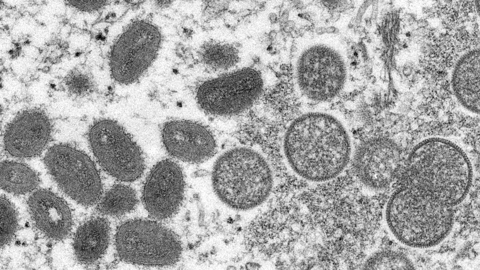 Na snímke z elektrónového mikroskopu z roku 2003, ktorú sprístupnilo Centrum pre kontrolu a prevenciu chorôb (CDC), sú zobrazené zrelé vírusové častice opičích kiahní
