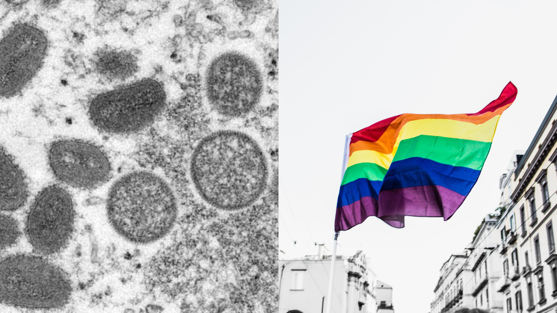 opičie kiahne, lgbt