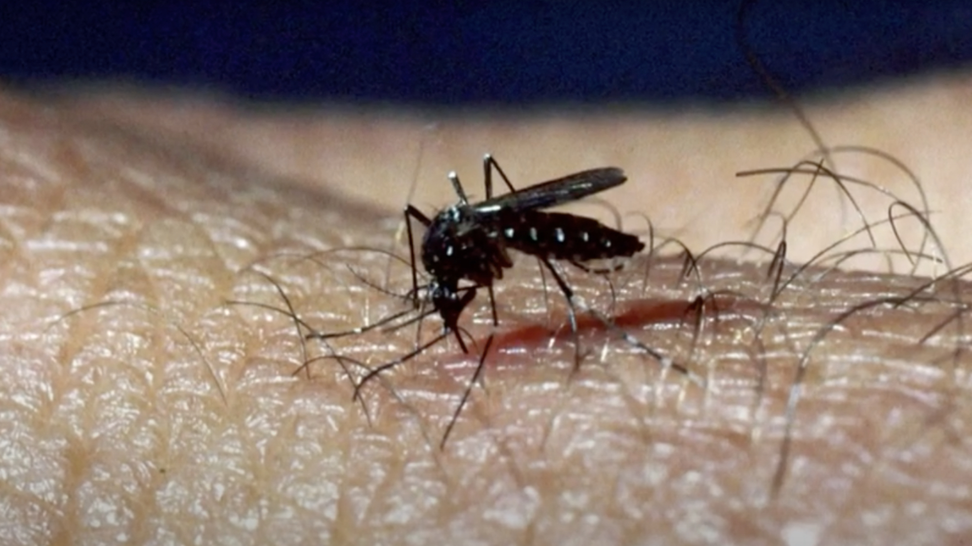 Komár na ruke človeka, útočí a spôsobuje západonílsku horúčku