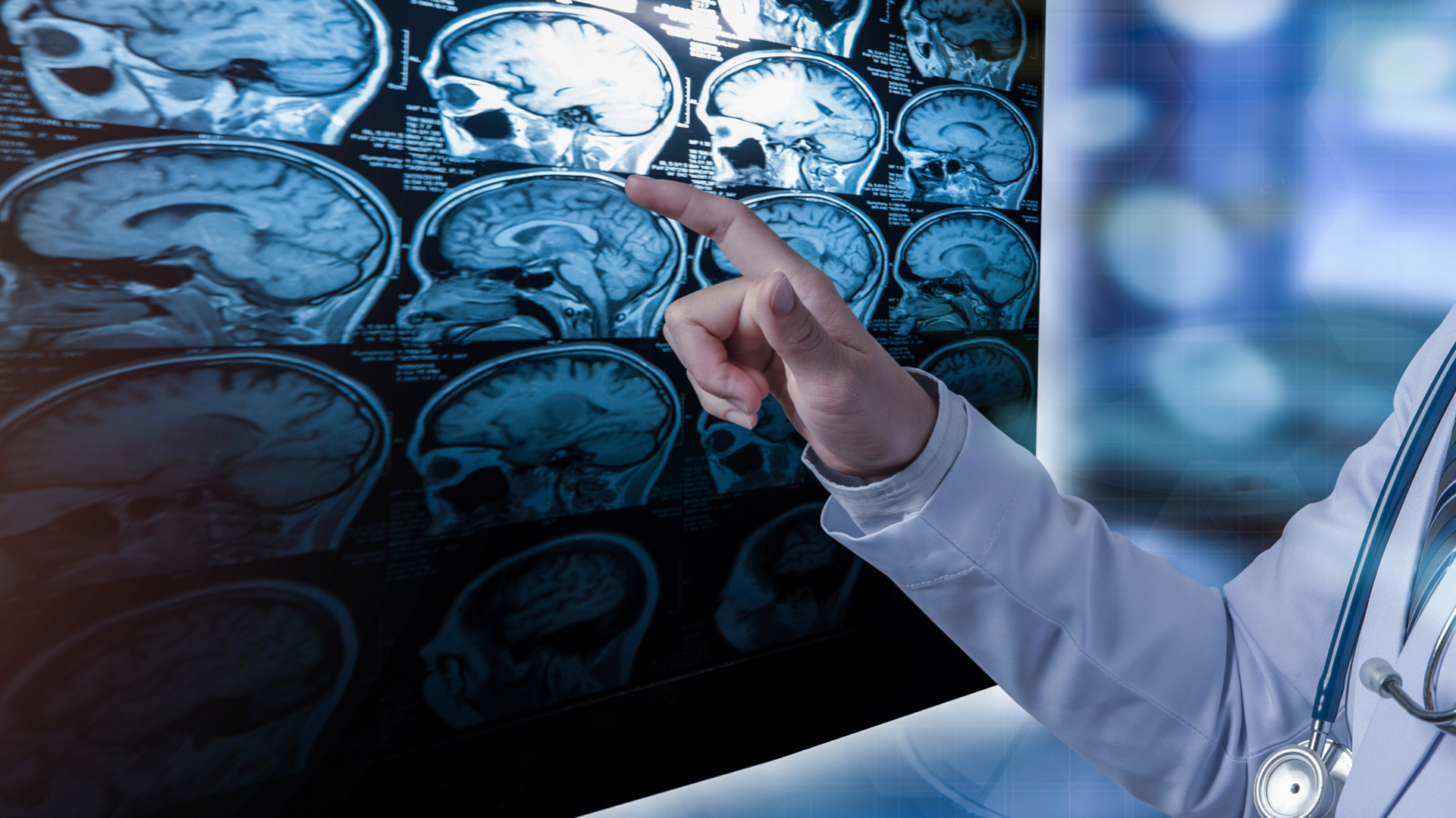 lekár ukazujúci na snímky mozgu
