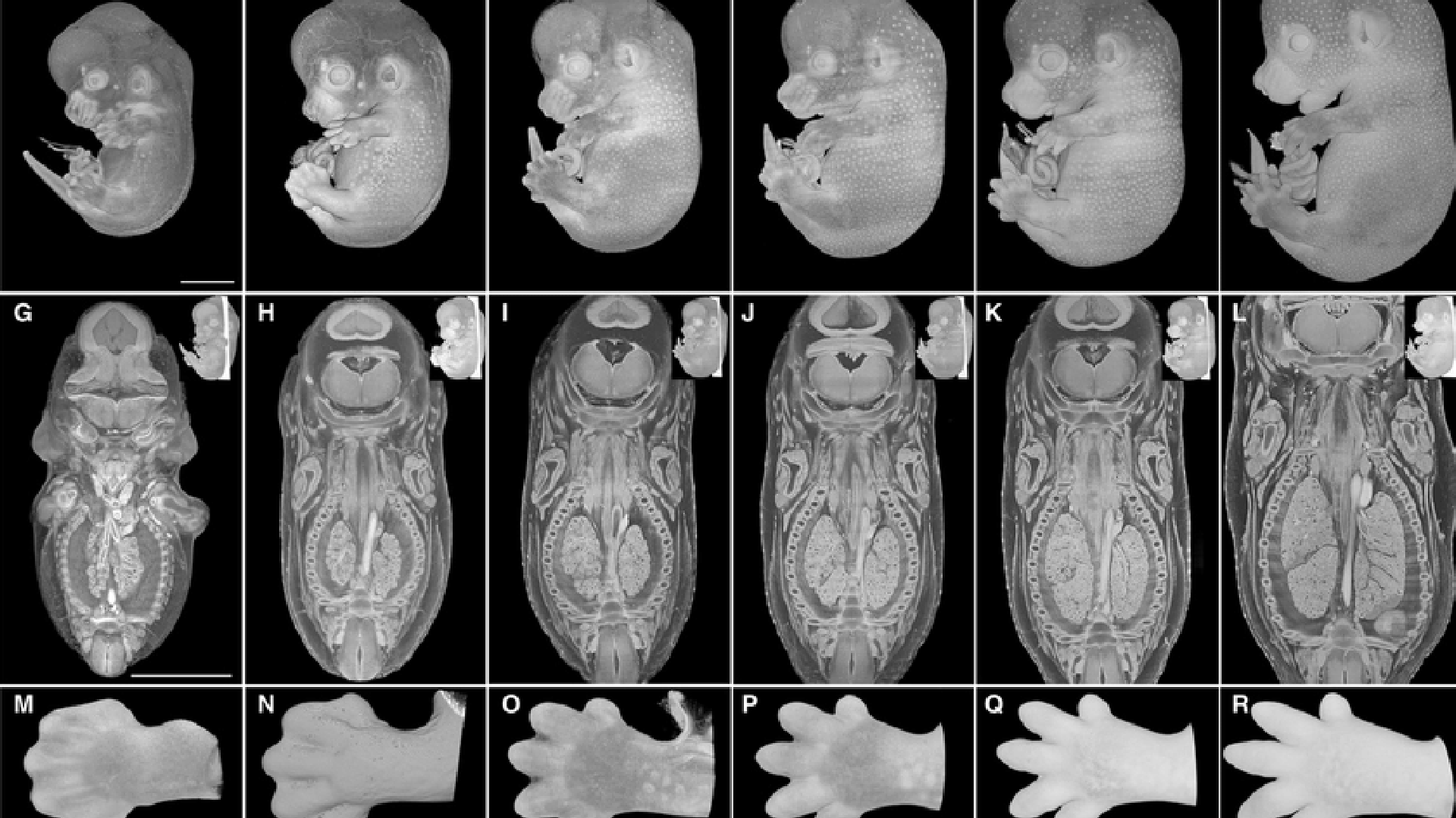 vývoj embry v maternici