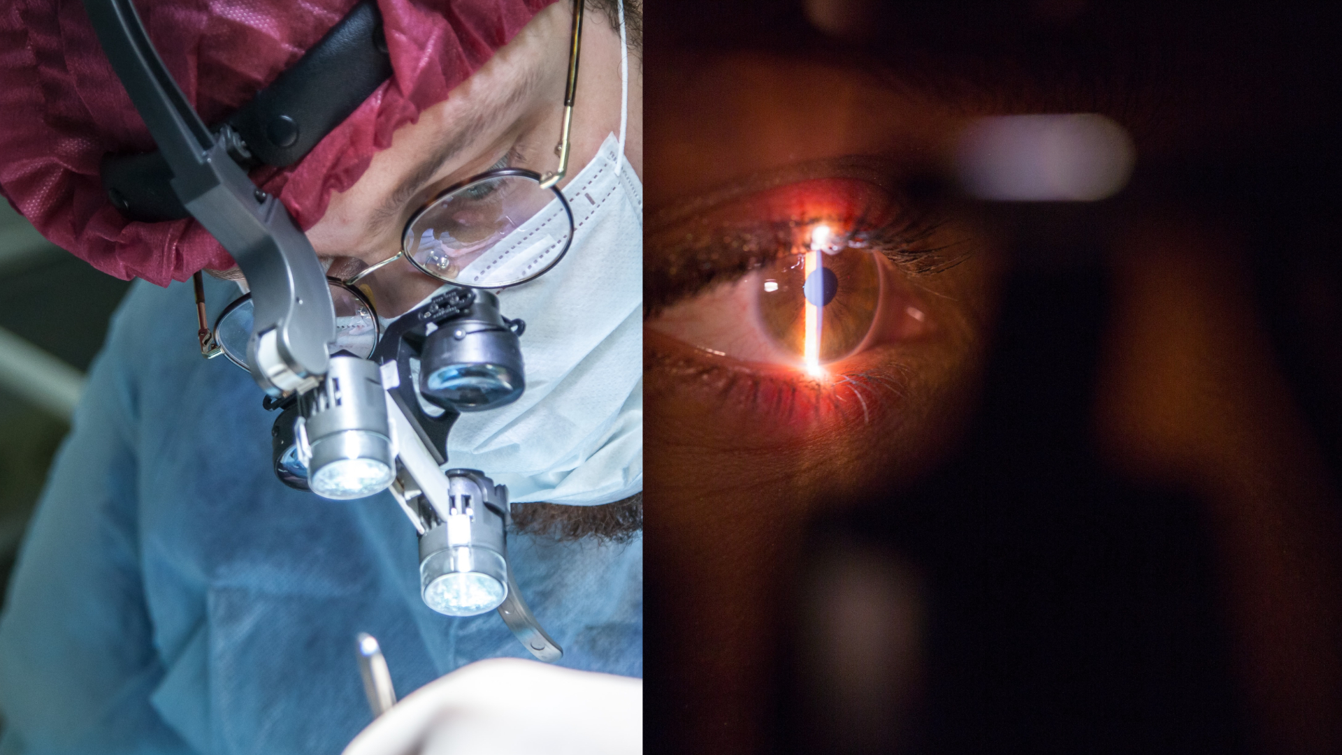 operácia očí, iclinic