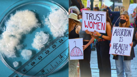 Rast tkaniva od 5. do 9. týždňa tehotenstva, protest proti zákazu interrupcií