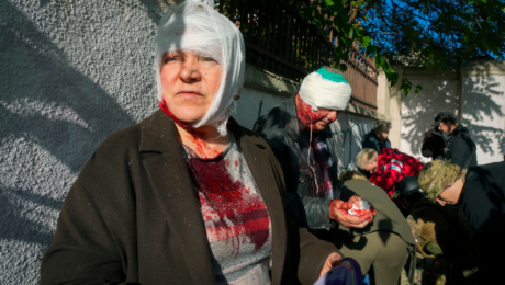 Ľudia v Kyjeve utrpeli po ex0plóziách vážne zranenia.