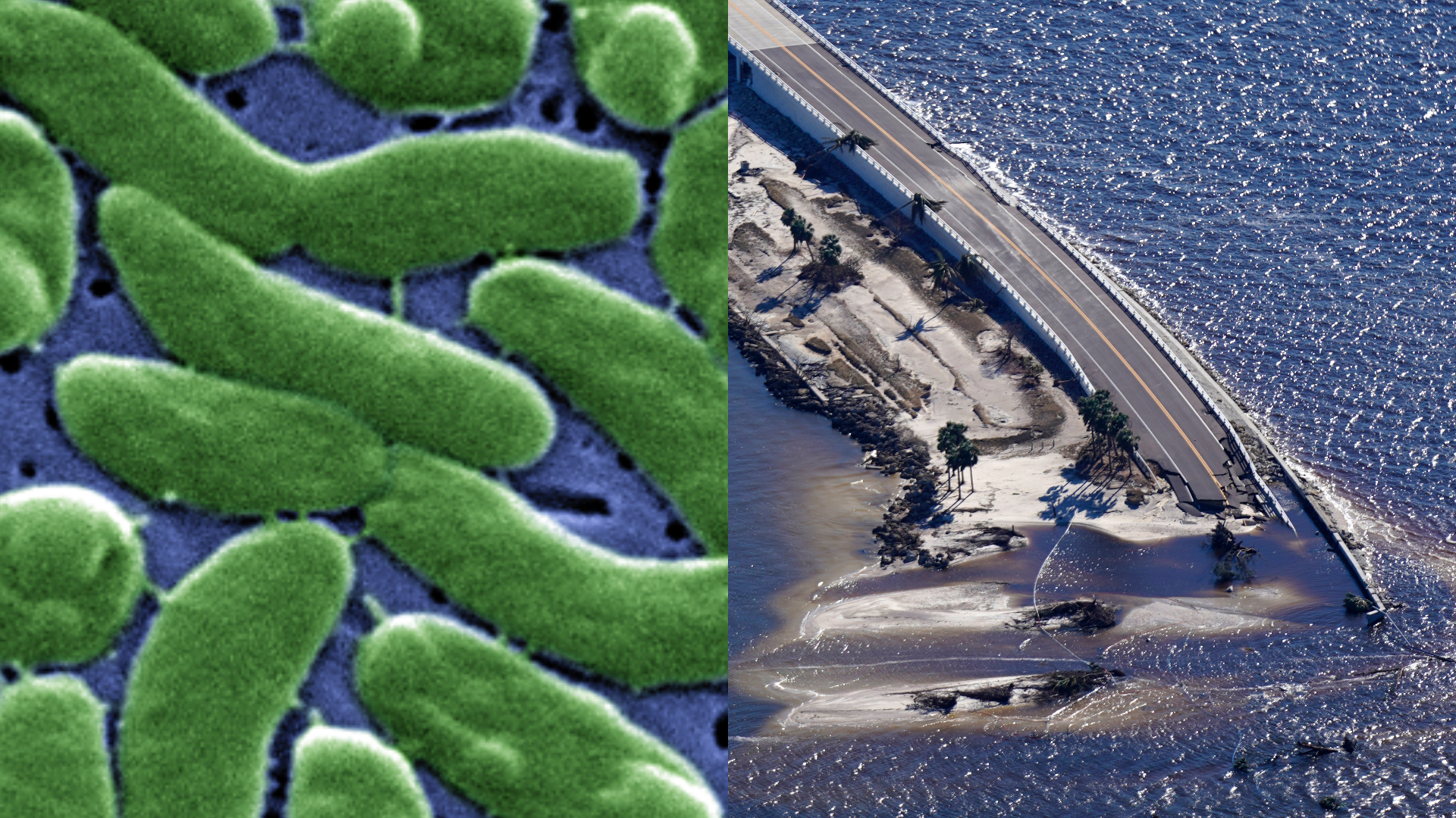 Baktéria Vibrio vulnificus požierajúca mäso a zničená Florida