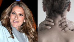 Jedna z milióna. Céline Dion trpí desivým ochorením, ktoré robí z ľudí „živé sochy“