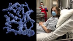 vírus, choroba, ochorenie