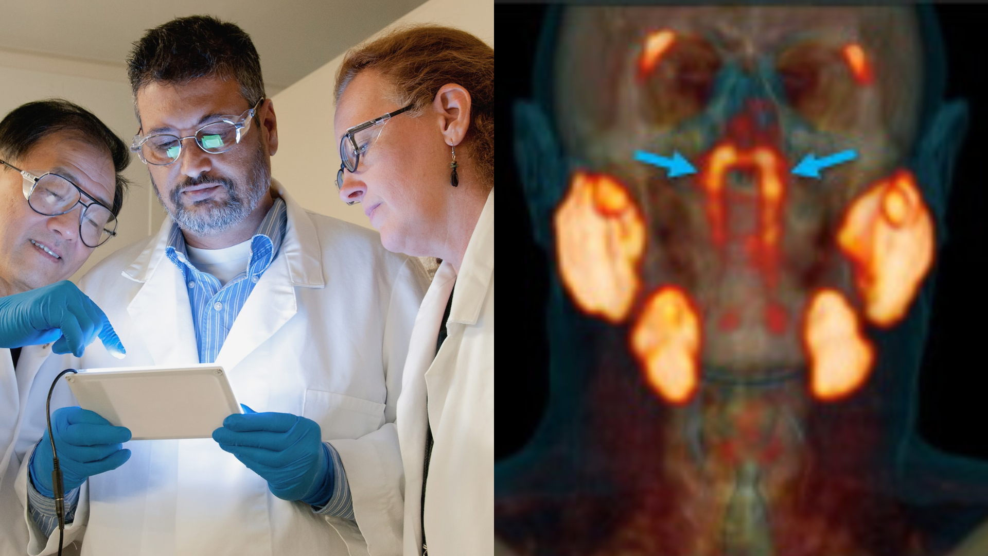 Tím vedcov a nový orgán na skene